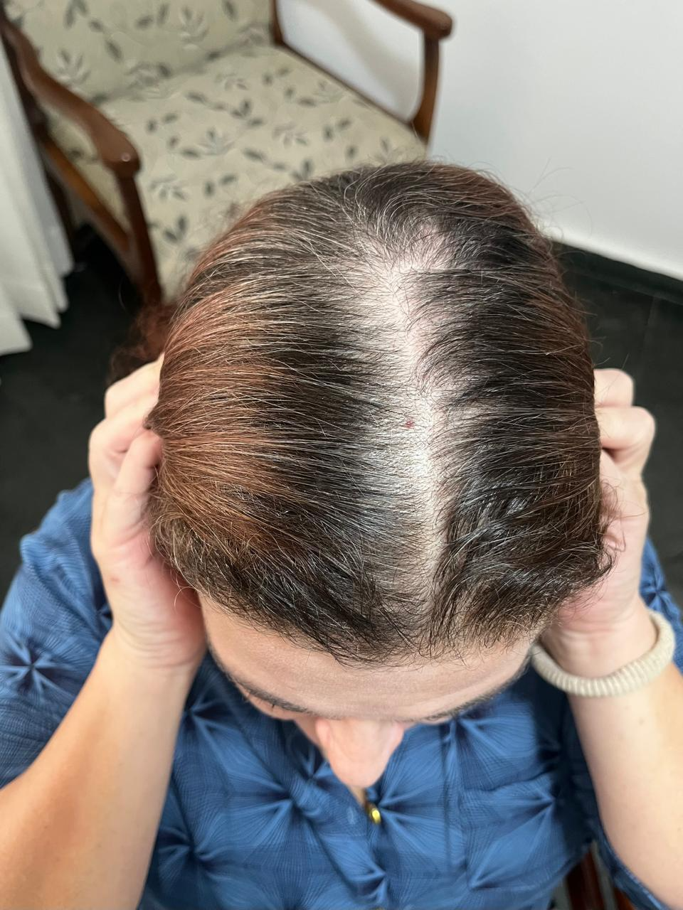 Visual antes do tratamento